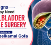 gallbladder stone surgery in Ghaziabad