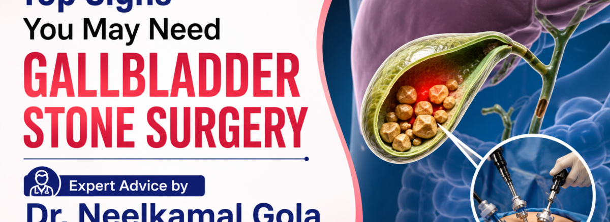 gallbladder stone surgery in Ghaziabad