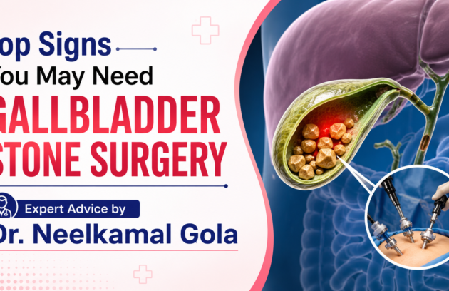 gallbladder stone surgery in Ghaziabad